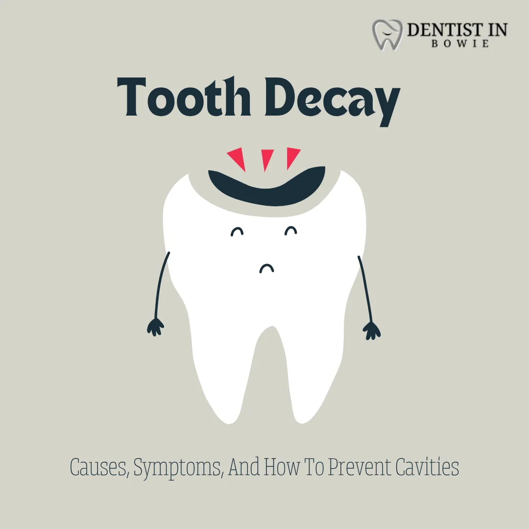 Tooth Decay Causes, Symptoms, And How To Prevent Cavities