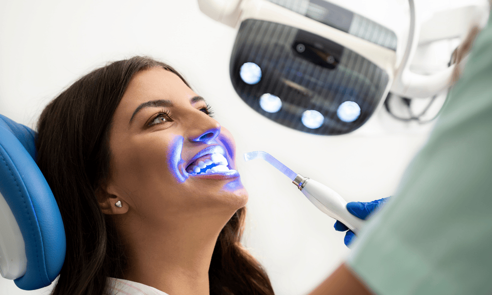 Teeth Whitening vs. Teeth Bonding